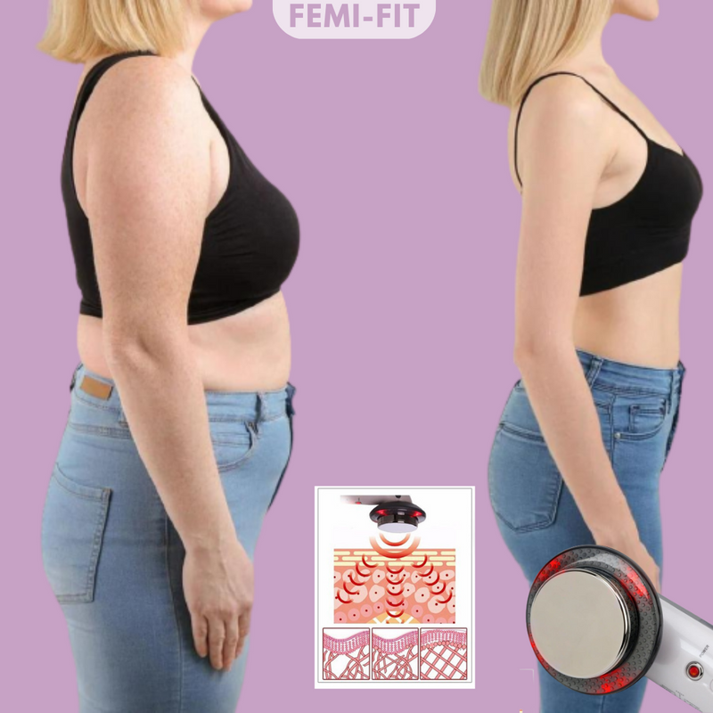 Cellulite-Entferner | Vielseitig | Effektiv | EMS-Technologie | Langlebig | Kompakt-Luzern Mode