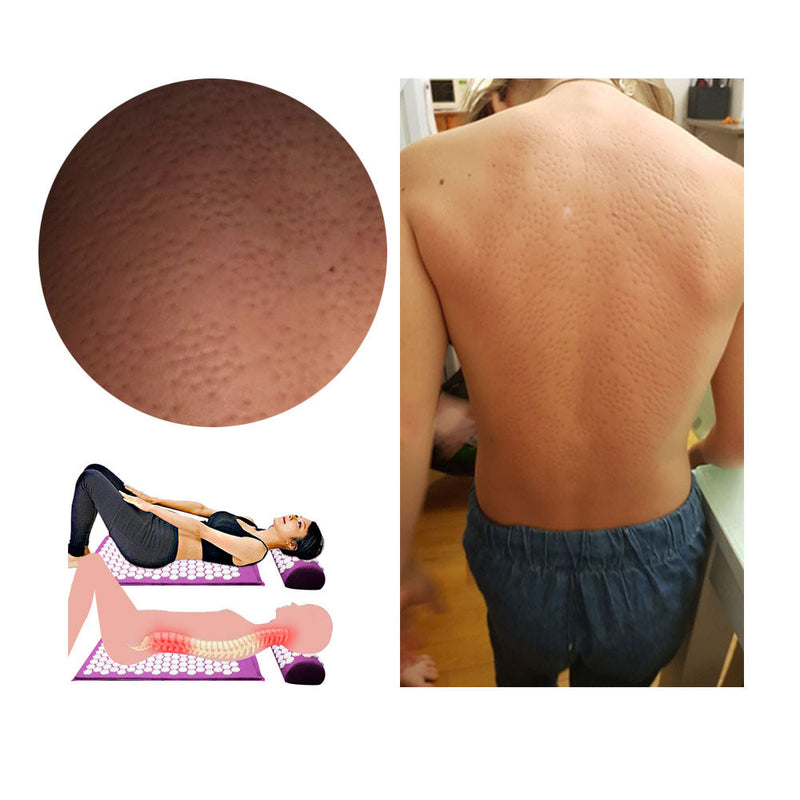 Yogamatten-Set | Kissen | Akupressur | Entspannend | Komfortabel | Langlebig-Luzern Mode