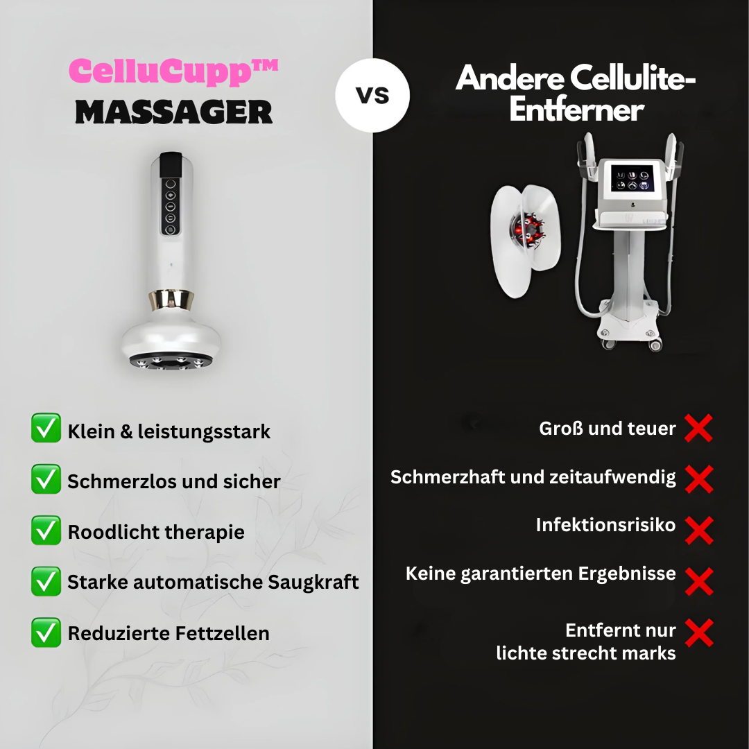 Cupping-Gerät | Anti-Cellulite Kompakt Vielseitig Effektiv USB-Luzern Mode