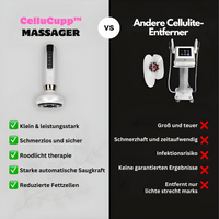 Cupping-Gerät | Anti-Cellulite Kompakt Vielseitig Effektiv USB-Luzern Mode