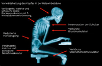 Haltungsbandage | EMS Verstellbar Korrigierend Komfortabel Atmungsaktiv-Luzern Mode