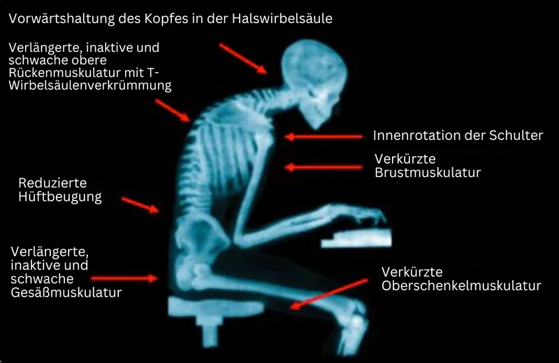 Haltungsbandage | EMS Verstellbar Korrigierend Komfortabel Atmungsaktiv-Luzern Mode