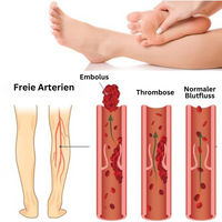 Fußmassagematte | EMS Akupressur Innovativ Bequem Beruhigend-Luzern Mode