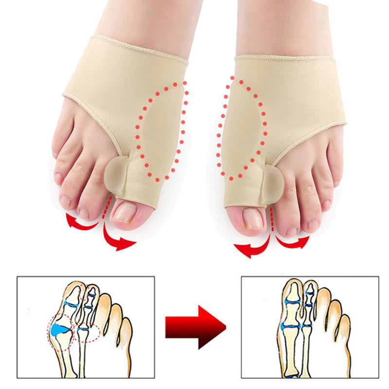 Orthopädische Hallux Valgus Zehenspreizer mit Gelpolster-Luzern Mode
