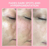Gesichtsreinigungspads | Kurkuma | Kojic-Säure | Tiefe Reinigung-Luzern Mode