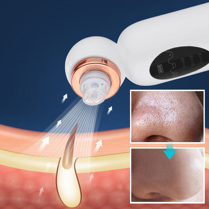 Mitesser Entferner | Hydrodermabrasion Hautpflege Gesicht-Luzern Mode