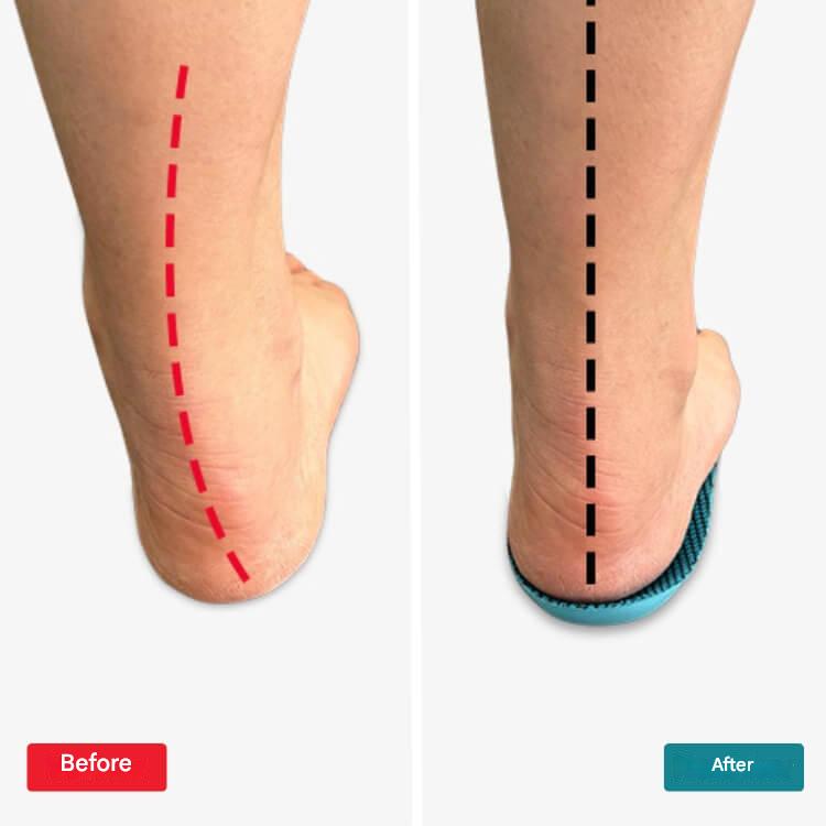 Einlegesohlen | Orthopädisch | Memory-Schaum | Schmerzlinderung | Dämpfend-Luzern Mode