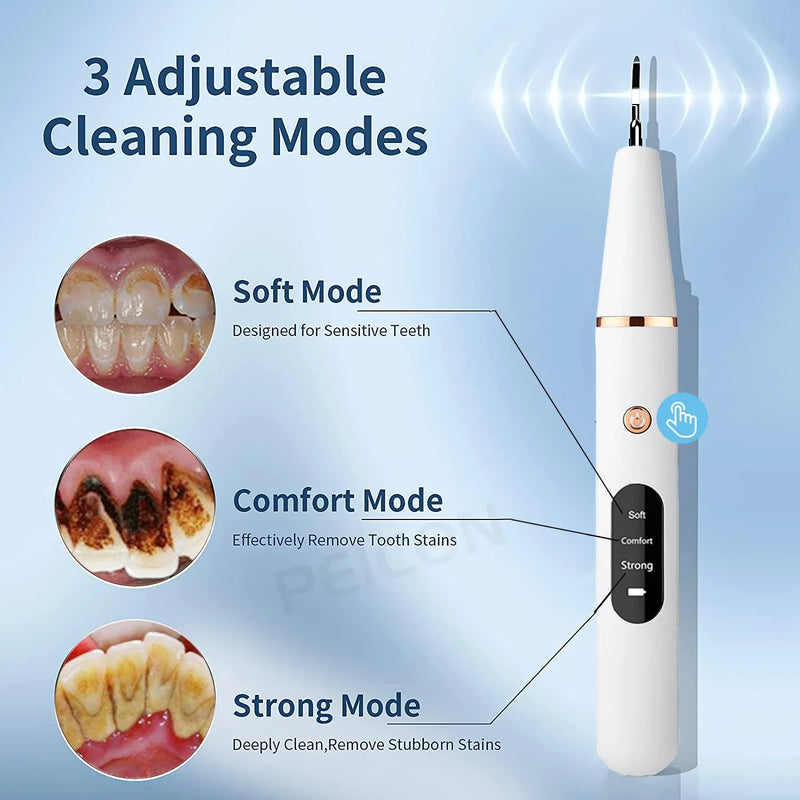Zahnbürste | Ultraschall Zahnsteinentfernung Hygiene SonicClean-Luzern Mode